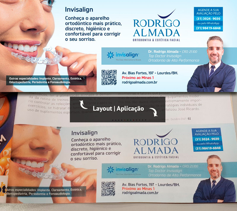 Arcadas amplas para um sorriso perfeito - Invisalign BH - Clínica Rodrigo  Almada